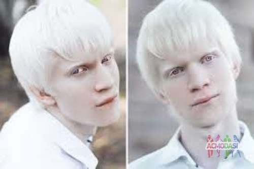 &quot;Эбигейл&quot; требуется парень-альбинос